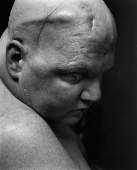 Black-and-white photograph of a man's head and shoulders.